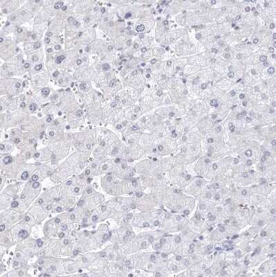 Immunohistochemistry-Paraffin: CCDC181 Antibody [NBP1-93898]