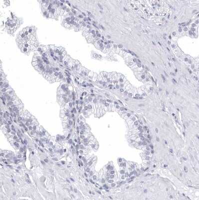 Immunohistochemistry-Paraffin: CCDC181 Antibody [NBP1-93898]