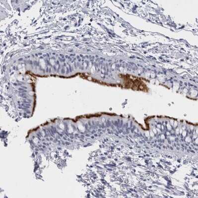 Immunohistochemistry-Paraffin: CCDC181 Antibody [NBP1-93899]