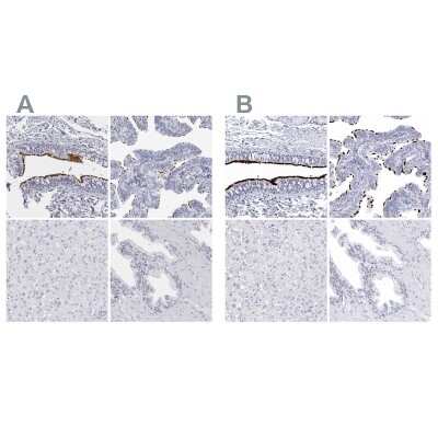 Immunohistochemistry-Paraffin: CCDC181 Antibody [NBP1-93899]