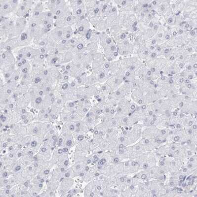 Immunohistochemistry-Paraffin: CCDC181 Antibody [NBP1-93899]