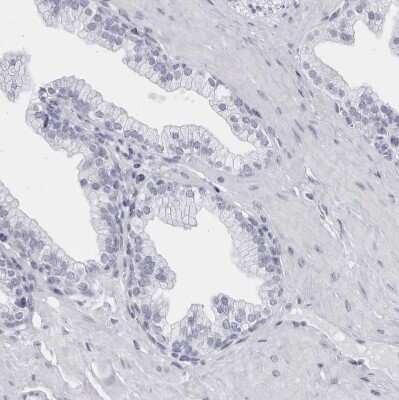 Immunohistochemistry-Paraffin: CCDC181 Antibody [NBP1-93899]