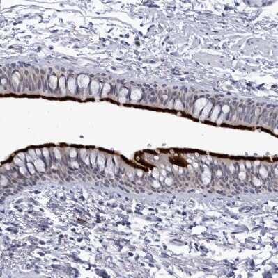 Immunohistochemistry-Paraffin: CCDC181 Antibody [NBP1-93900]