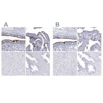 Immunohistochemistry-Paraffin: CCDC181 Antibody [NBP1-93900]