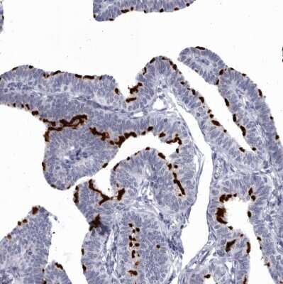 Immunohistochemistry-Paraffin: CCDC181 Antibody [NBP1-93900]