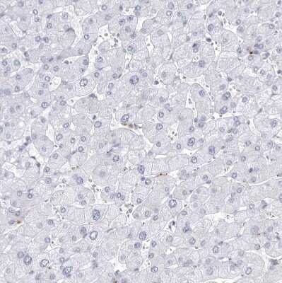 Immunohistochemistry-Paraffin: CCDC181 Antibody [NBP1-93900]