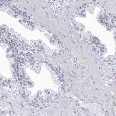 Immunohistochemistry-Paraffin: CCDC181 Antibody [NBP1-93900]