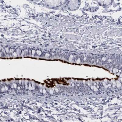 Immunohistochemistry-Paraffin: CCDC181 Antibody [NBP1-93901]