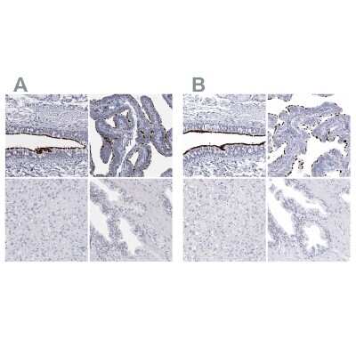 Immunohistochemistry-Paraffin: CCDC181 Antibody [NBP1-93901]