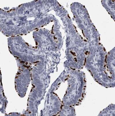 Immunohistochemistry-Paraffin: CCDC181 Antibody [NBP1-93901]