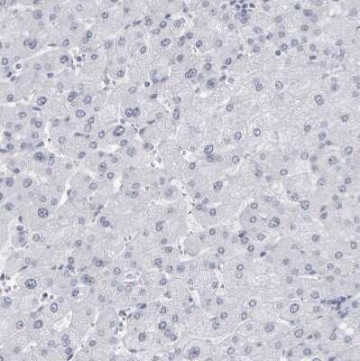 Immunohistochemistry-Paraffin: CCDC181 Antibody [NBP1-93901]