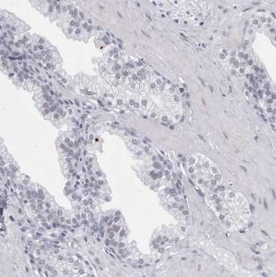 Immunohistochemistry-Paraffin: CCDC181 Antibody [NBP1-93901]