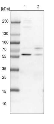 Western Blot: CCDC181 Antibody [NBP1-93901]