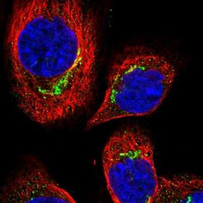 Immunocytochemistry/ Immunofluorescence: CCDC186 Antibody [NBP1-90440]