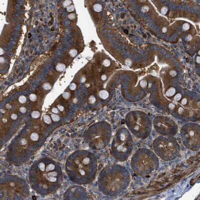 Immunohistochemistry-Paraffin: CCDC186 Antibody [NBP1-90440]