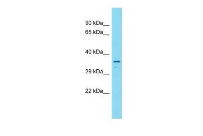 Western Blot: CCDC189 Antibody [NBP2-84605]
