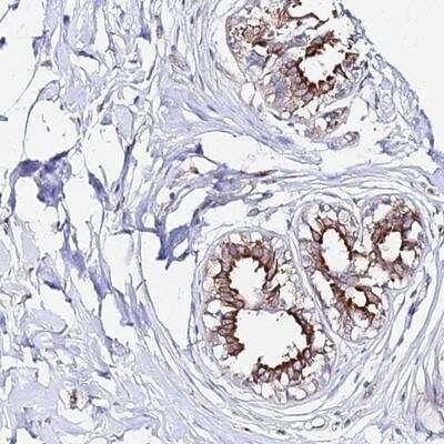 Immunohistochemistry: CCDC19 Antibody [NBP1-91757]