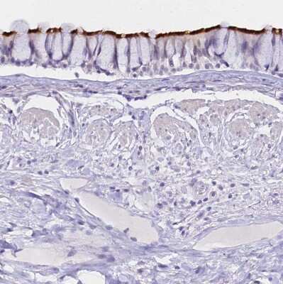 Immunohistochemistry-Paraffin: CCDC19 Antibody [NBP1-91758]