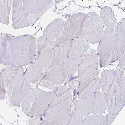 Immunohistochemistry-Paraffin: CCDC19 Antibody [NBP1-91758]