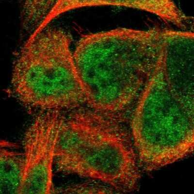 Immunocytochemistry/ Immunofluorescence: CCDC22 Antibody [NBP1-84331]