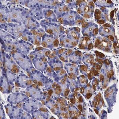 Immunohistochemistry-Paraffin: CCDC22 Antibody [NBP1-84331]