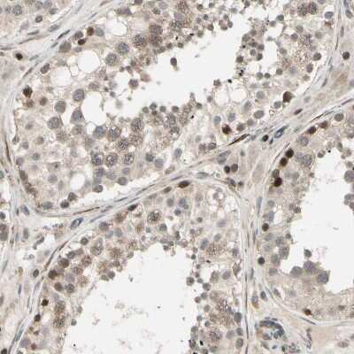 Immunohistochemistry-Paraffin: CCDC23 Antibody [NBP1-81071]