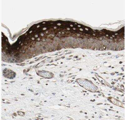 Immunohistochemistry-Paraffin: CCDC23 Antibody [NBP1-81071]