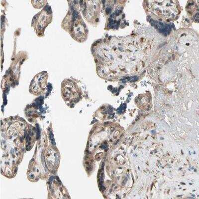 Immunohistochemistry-Paraffin: CCDC23 Antibody [NBP1-81071]