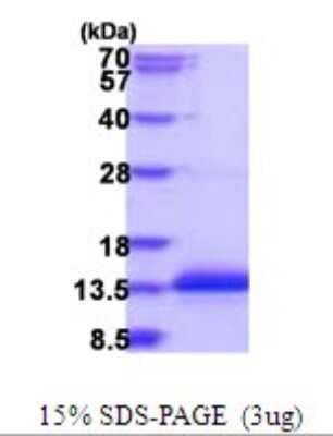 SDS-PAGE: Recombinant Human CCDC23 His Protein [NBP2-51902]