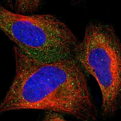 Immunocytochemistry/ Immunofluorescence: CCDC24 Antibody [NBP2-34179]