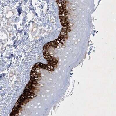 Immunohistochemistry: CCDC24 Antibody [NBP2-34179]