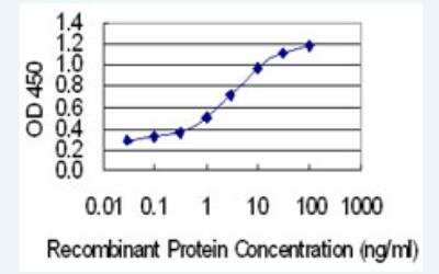 ELISA: CCDC28A Antibody (6F2) [H00025901-M02-100ug]