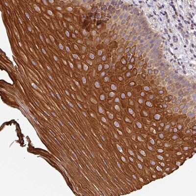 Immunohistochemistry-Paraffin: CCDC28A Antibody [NBP2-30457]