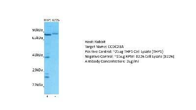 Western Blot: CCDC28A Antibody [NBP2-87147]