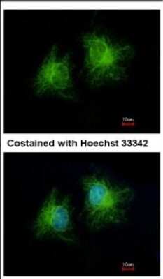 Immunocytochemistry/ Immunofluorescence: CCDC28B Antibody [NBP2-15747]