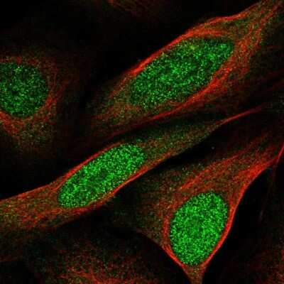 Immunocytochemistry/ Immunofluorescence: CCDC3 Antibody [NBP2-56013]