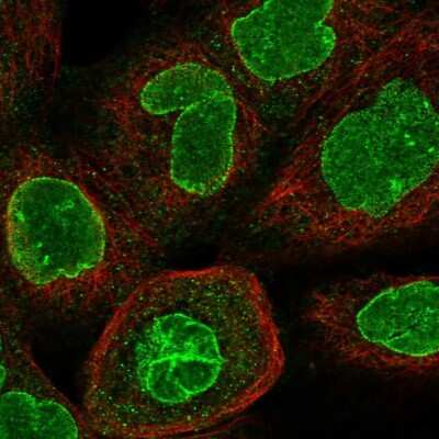 Immunocytochemistry/ Immunofluorescence: CCDC34 Antibody [NBP1-93558]