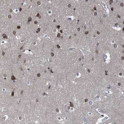 Immunohistochemistry-Paraffin: CCDC34 Antibody [NBP1-93558]
