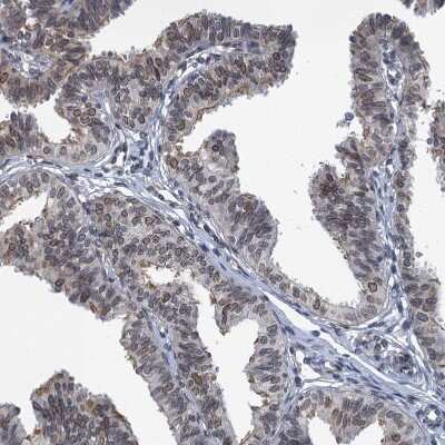 Immunohistochemistry-Paraffin: CCDC34 Antibody [NBP1-93558]