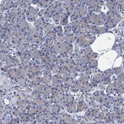 Immunohistochemistry-Paraffin: CCDC34 Antibody [NBP1-93558]