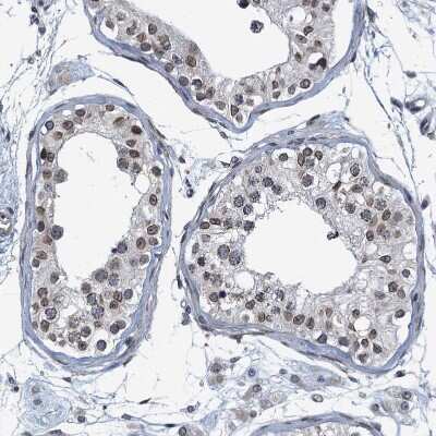 Immunohistochemistry-Paraffin: CCDC34 Antibody [NBP1-93558]