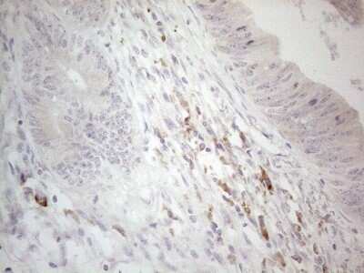 Immunohistochemistry: CCDC36 Antibody (OTI2D11) [NBP2-46074]