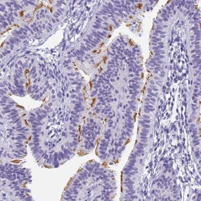 Immunohistochemistry-Paraffin: CCDC37 Antibody [NBP2-14449]