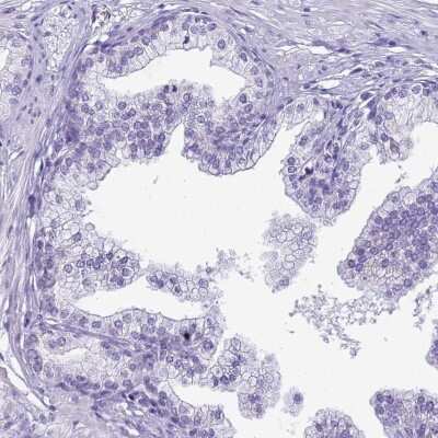 Immunohistochemistry-Paraffin: CCDC37 Antibody [NBP2-14449]