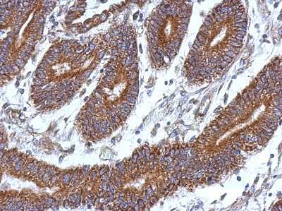 Immunohistochemistry-Paraffin: CCDC37 Antibody [NBP2-15748]