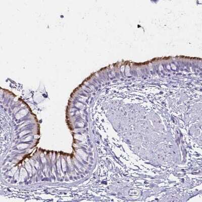 Immunohistochemistry-Paraffin: CCDC39 Antibody [NBP1-90560]
