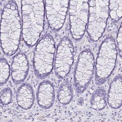 Immunohistochemistry-Paraffin: CCDC39 Antibody [NBP1-90560]