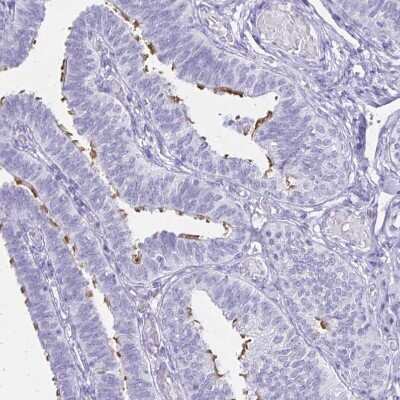 Immunohistochemistry-Paraffin: CCDC39 Antibody [NBP2-33999]