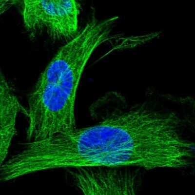 Immunocytochemistry/ Immunofluorescence: CCDC40 Antibody [NBP1-82162]