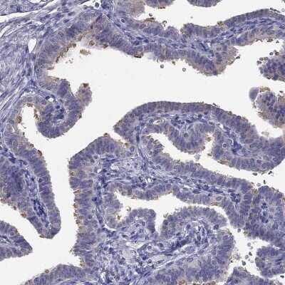 Immunohistochemistry-Paraffin: CCDC40 Antibody [NBP1-82162]